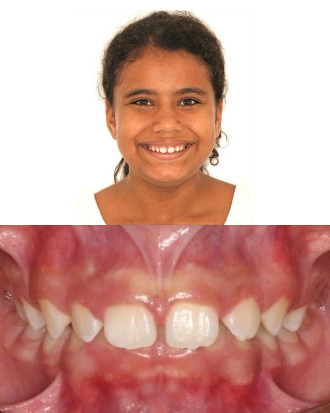 Caso 01 - Antes