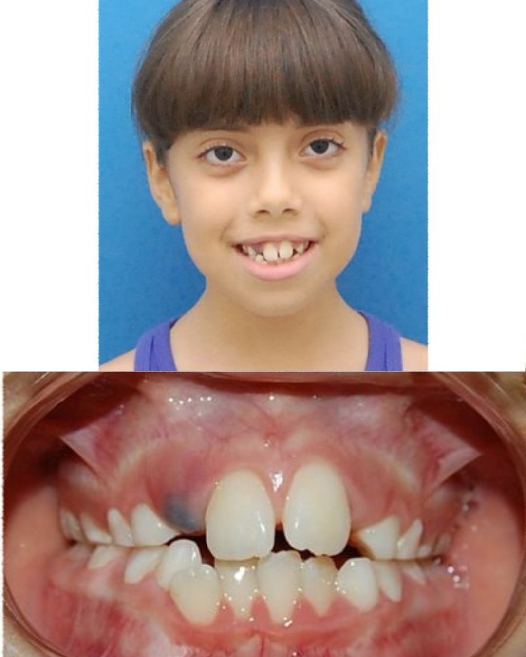 Caso 02 - Antes